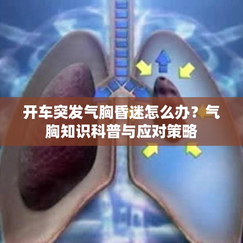 开车突发气胸昏迷怎么办？气胸知识科普与应对策略