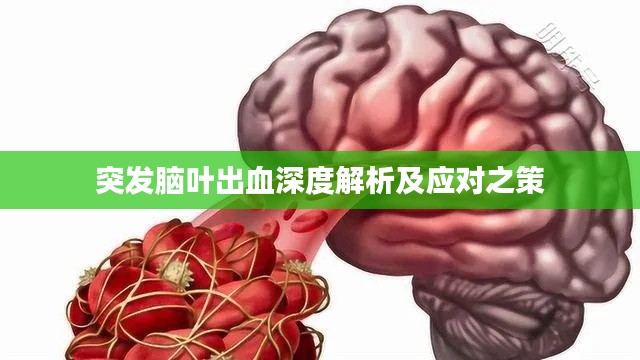 突发脑叶出血深度解析及应对之策