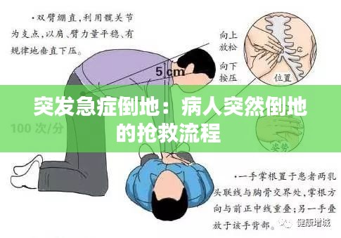 突发急症倒地：病人突然倒地的抢救流程 