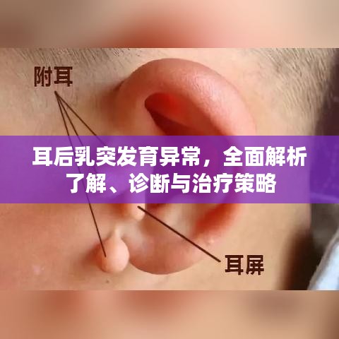 耳后乳突发育异常，全面解析了解、诊断与治疗策略