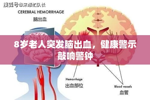 8岁老人突发脑出血，健康警示敲响警钟