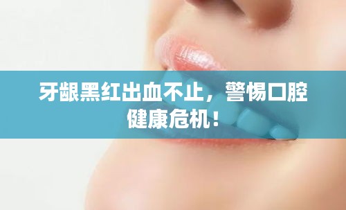 牙龈黑红出血不止，警惕口腔健康危机！