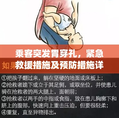 乘客突发胃穿孔，紧急救援措施及预防措施详解