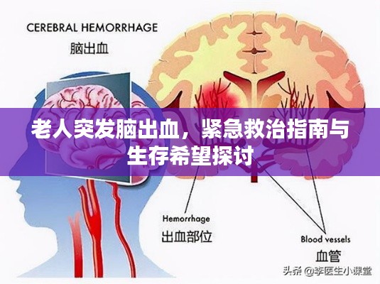 老人突发脑出血，紧急救治指南与生存希望探讨