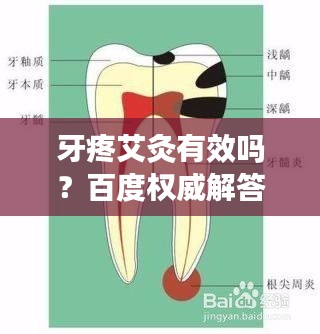 牙疼艾灸有效吗？百度权威解答！