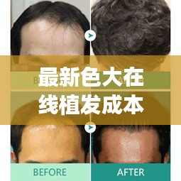 最新色大在线植发成本与长春植发价格解析，真实信息揭秘，避免虚假宣传陷阱