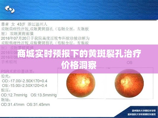 商城实时预报下的黄斑裂孔治疗价格洞察