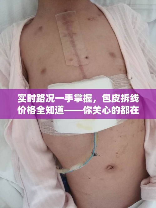 实时路况一手掌握，包皮拆线价格全知道——你关心的都在这里！