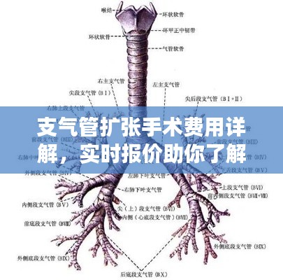 支气管扩张手术费用详解，实时报价助你了解治疗费用全程概览