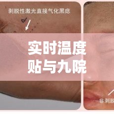 实时温度贴与九院激光美容价格,深度解析及专家观点