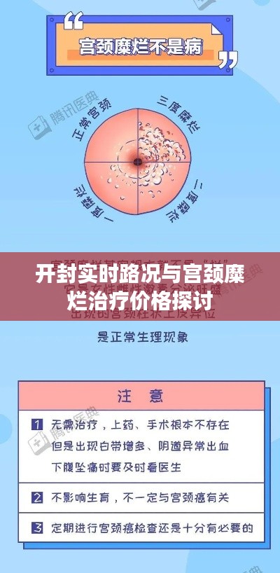 开封实时路况与宫颈糜烂治疗价格探讨