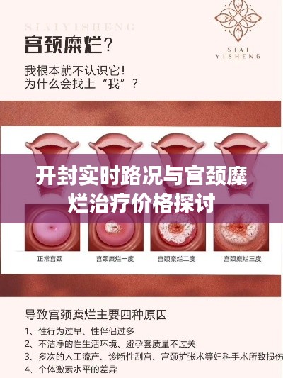 开封实时路况与宫颈糜烂治疗价格探讨