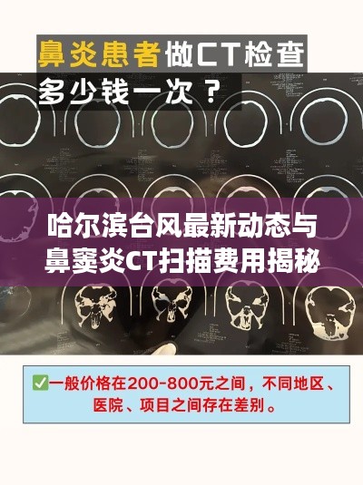 哈尔滨台风最新动态与鼻窦炎CT扫描费用揭秘